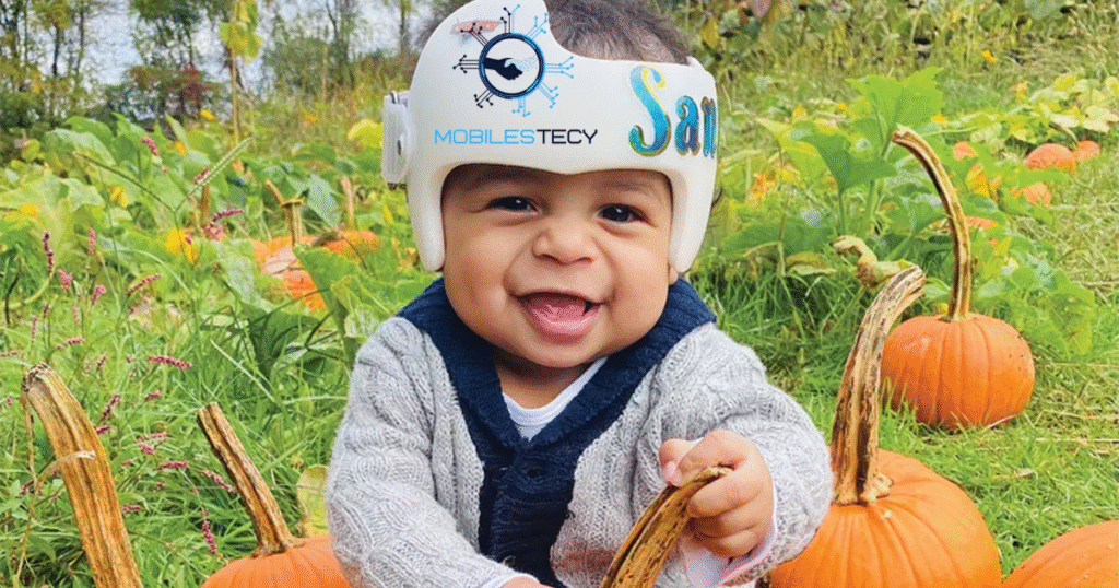 How the DOC Band Works to Reshape Your Baby’s Head