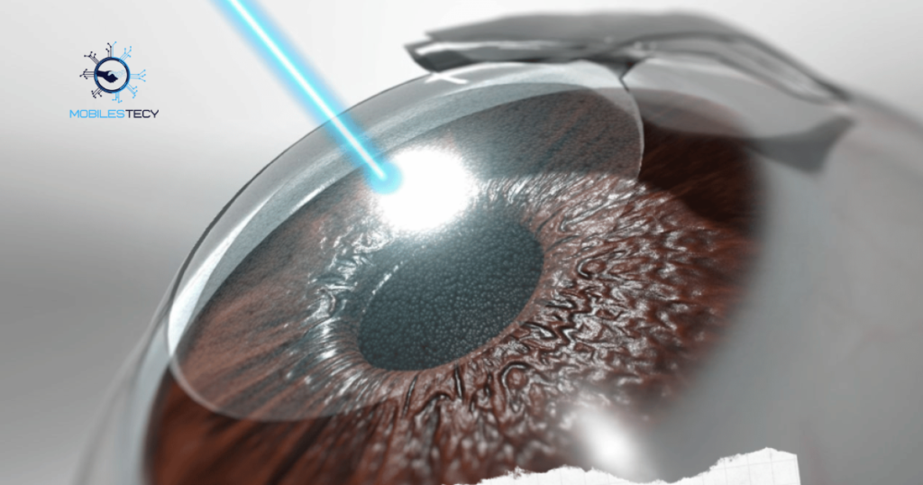 Understanding Why LASIK Is Usually Not Covered