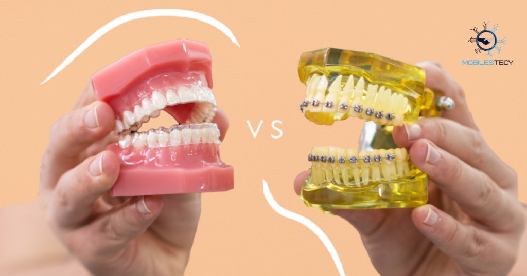 Comparing Invisalign and Traditional Braces Costs