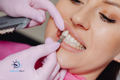 Does Insurance Cover Veneers?