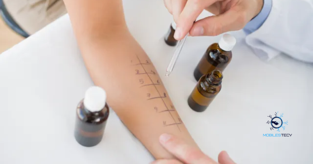 Insurance Coverage for Allergy Tests