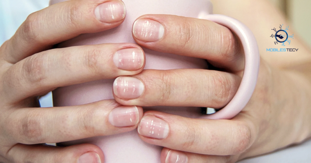 Nail Color Changes and Health Meanings