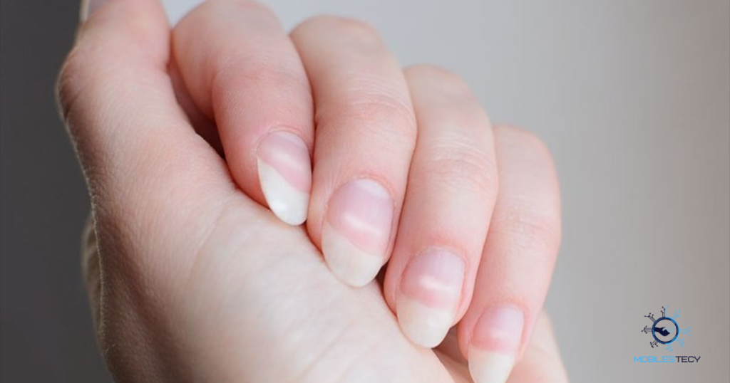 Nail Shape Texture and Growth Patterns