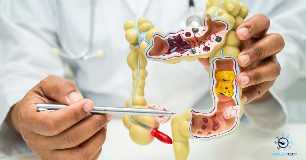 How Health Insurance Covers Colonoscopy