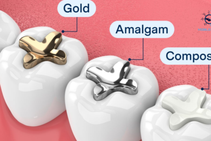 How Much Is a Cavity Filling Without Insurance?