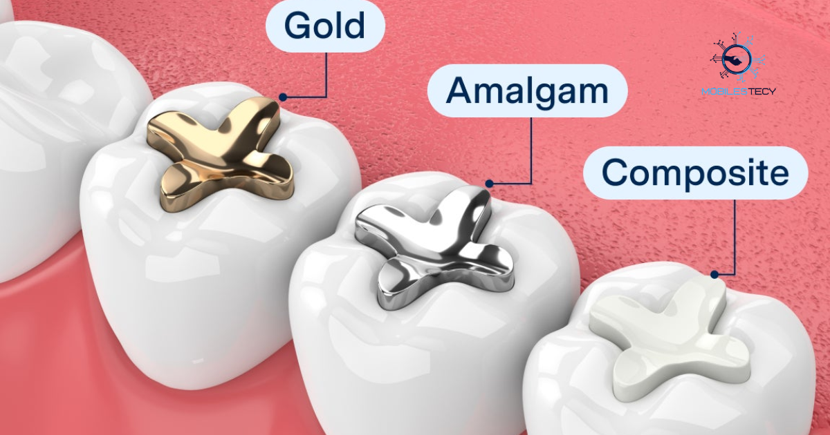 How Much Is a Cavity Filling Without Insurance?