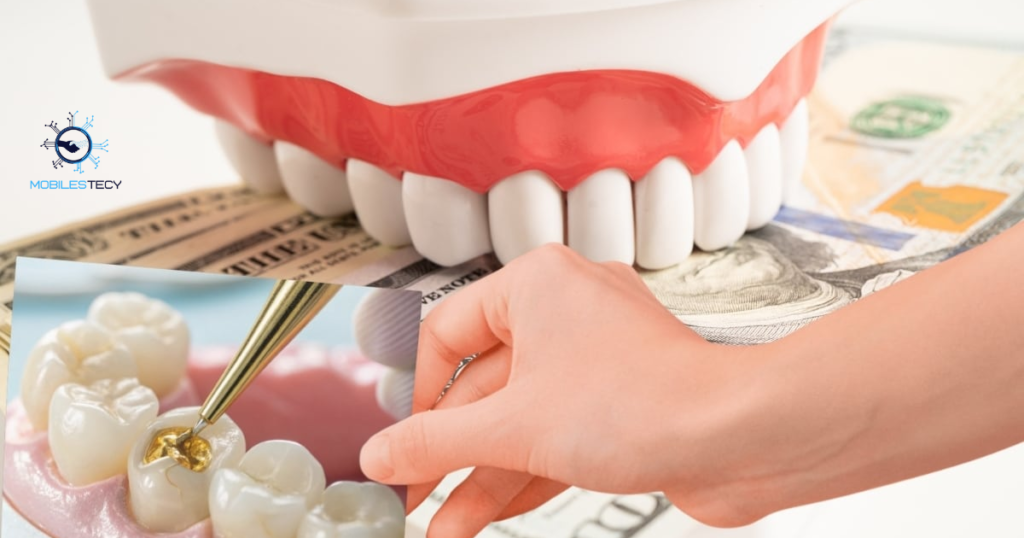 Factors Affecting Cavity Filling Costs